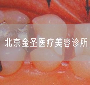 北京金圣医疗美容诊所(图1) 北京金圣医疗美容诊所(图1)