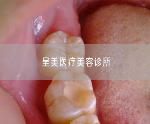 呈美医疗美容诊所(图1) 呈美医疗美容诊所(图1)