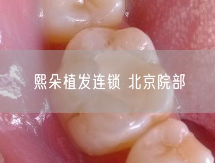 熙朵植发连锁 北京院部(图1) 熙朵植发连锁 北京院部(图1)