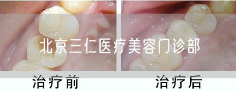 北京三仁医疗美容门诊部(图1) 北京三仁医疗美容门诊部(图1)