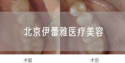 北京伊蕾雅医疗美容(图1) 北京伊蕾雅医疗美容(图1)