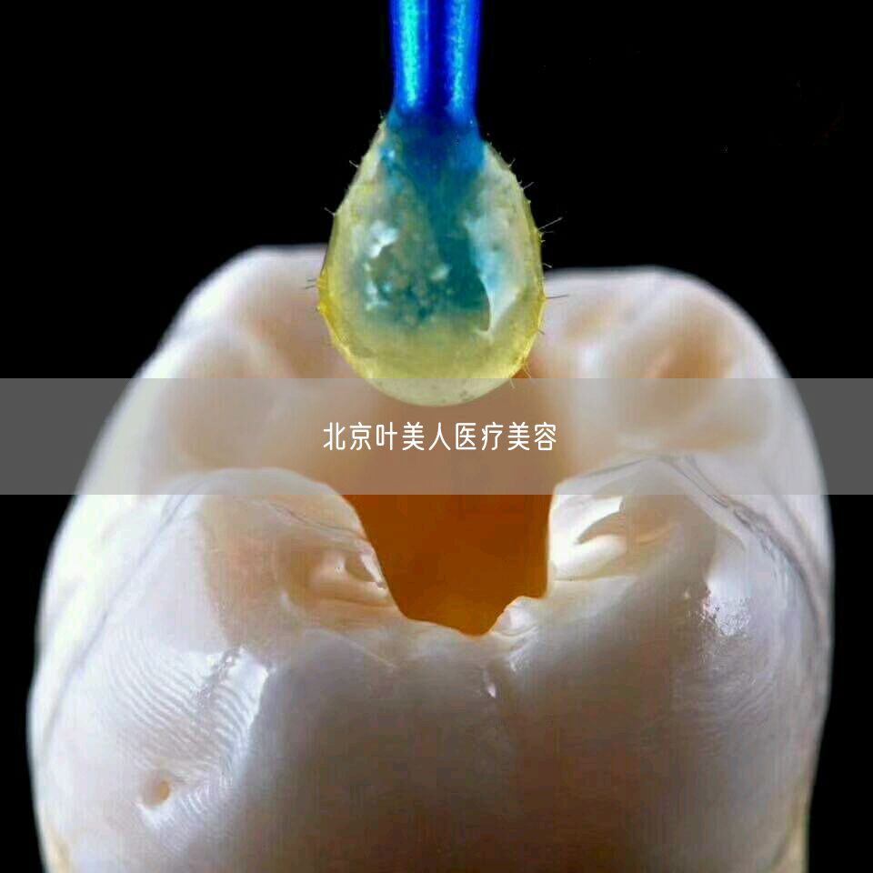 北京叶美人医疗美容(图1) 北京叶美人医疗美容(图1)