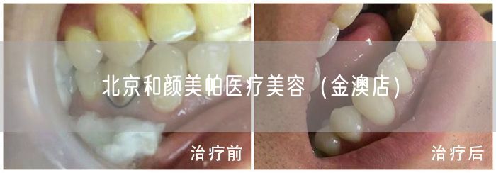 北京和颜美帕医疗美容(金澳店)(图1) 北京和颜美帕医疗美容(金澳店)(图1)