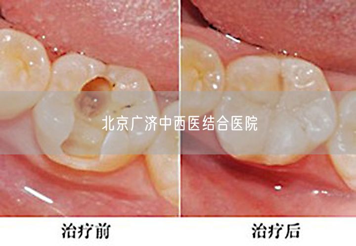 北京广济中西医结合医院(图1) 北京广济中西医结合医院(图1)