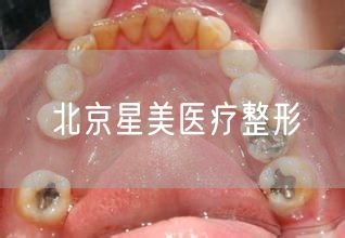 北京星美医疗整形(图1) 北京星美医疗整形(图1)