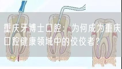 重庆牙博士口腔：为何成为重庆口腔健康领域中的佼佼者？