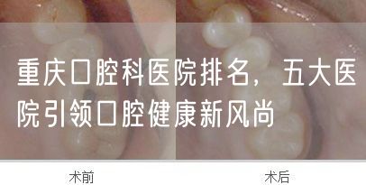 重庆口腔科医院排名，五大医院引领口腔健康新风尚(图1)