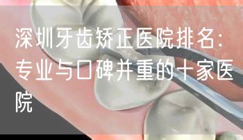 深圳牙齿矫正医院排名：专业与口碑并重的十家医院(图1)
