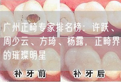 广州正畸专家排名榜：许跃、周少云、方琦、杨露，正畸界的璀璨明星