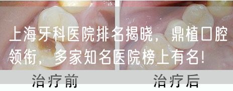 上海牙科医院排名揭晓，鼎植口腔领衔，多家知名医院榜上有名！(图1)