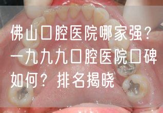 佛山口腔医院哪家强？一九九九口腔医院口碑如何？排名揭晓(图1)