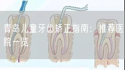 青岛儿童牙齿矫正指南：推荐医院一览(图1)