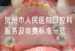 贺州市人民医院口腔科服务及收费标准一览(图1)