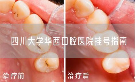 四川大学华西口腔医院挂号指南(图1)