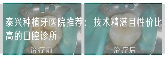 泰兴种植牙医院推荐：技术精湛且性价比高的口腔诊所(图1)