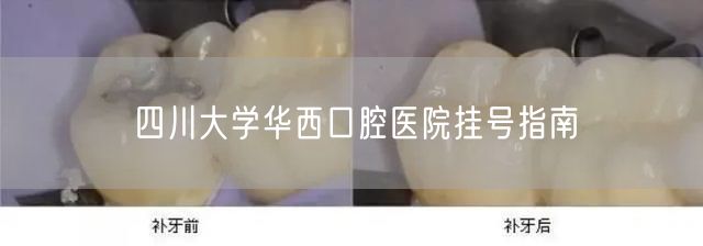 四川大学华西口腔医院挂号指南