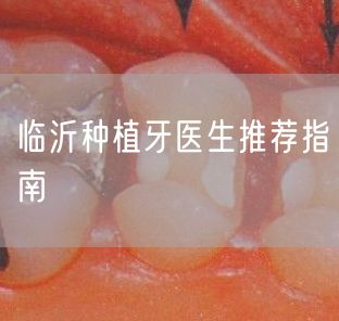 临沂种植牙医生推荐指南