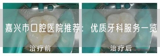 嘉兴市口腔医院推荐：优质牙科服务一览