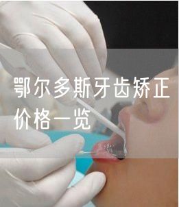 鄂尔多斯牙齿矫正价格一览