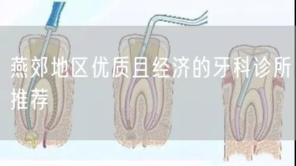 燕郊地区优质且经济的牙科诊所推荐(图1)