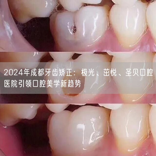 2024年成都牙齿矫正：极光、茁悦、圣贝口腔医院引领口腔美学新趋势