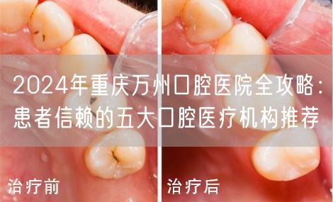 2024年重庆万州口腔医院全攻略：患者信赖的五大口腔医疗机构推荐