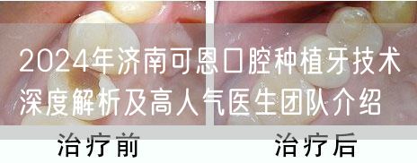 2024年济南可恩口腔种植牙技术深度解析及高人气医生团队介绍