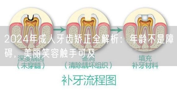 2024年成人牙齿矫正全解析：年龄不是障碍，美丽笑容触手可及