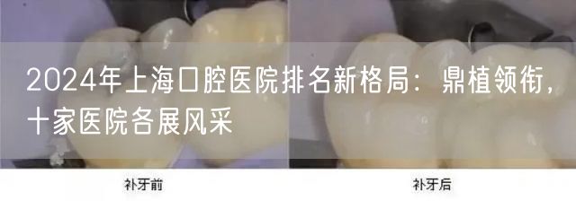 2024年上海口腔医院排名新格局：鼎植领衔，十家医院各展风采