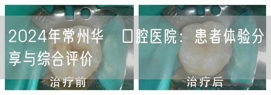 2024年常州华釾口腔医院：患者体验分享与综合评价