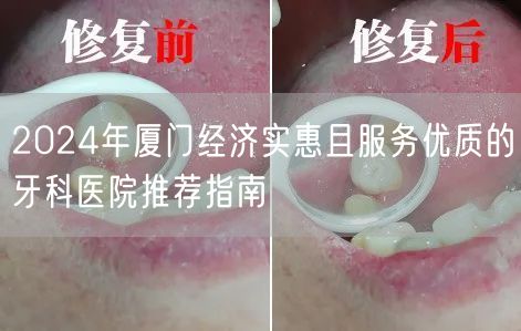 2024年厦门经济实惠且服务优质的牙科医院推荐指南