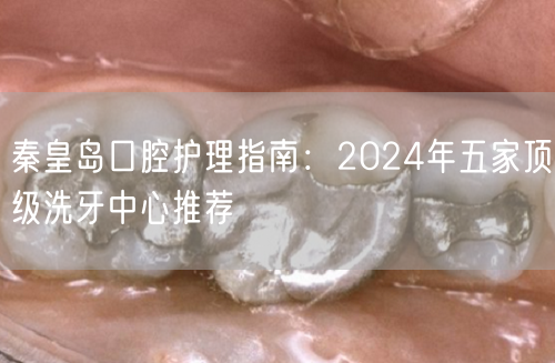 秦皇岛口腔护理指南：2024年五家顶级洗牙中心推荐