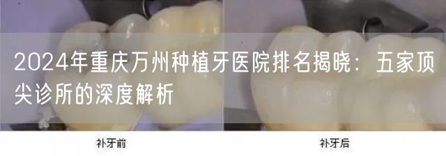 2024年重庆万州种植牙医院排名揭晓：五家顶尖诊所的深度解析