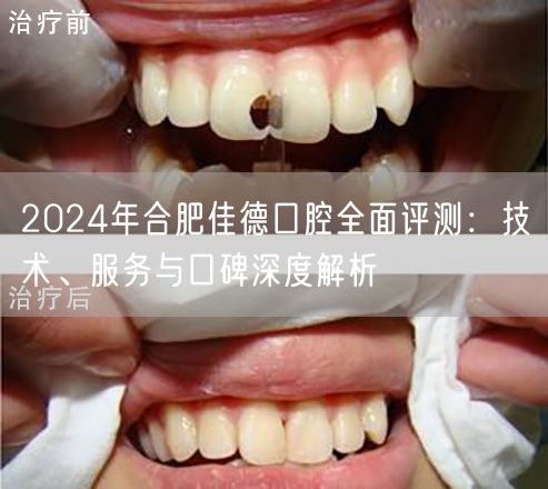 2024年合肥佳德口腔全面评测：技术、服务与口碑深度解析