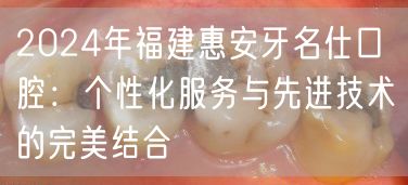 2024年福建惠安牙名仕口腔：个性化服务与先进技术的完美结合