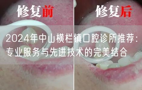 2024年中山横栏镇口腔诊所推荐：专业服务与先进技术的完美结合