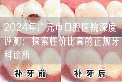 2024年广元市口腔医院深度评测：探索性价比高的正规牙科诊所