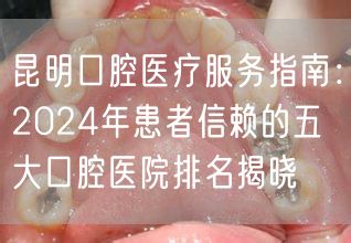 昆明口腔医疗服务指南：2024年患者信赖的五大口腔医院排名揭晓