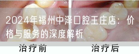 2024年福州中泽口腔王庄店：价格与服务的深度解析