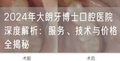 2024年大朗牙博士口腔医院深度解析：服务、技术与价格全揭秘