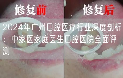 2024年广州口腔医疗行业深度剖析：中家医家庭医生口腔医院全面评测