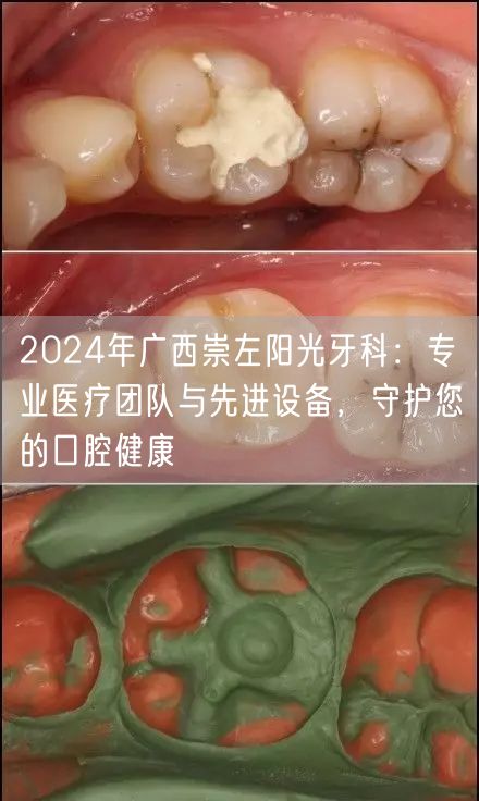 2024年广西崇左阳光牙科：专业医疗团队与先进设备，守护您的口腔健康