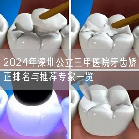 2024年深圳公立三甲医院牙齿矫正排名与推荐专家一览