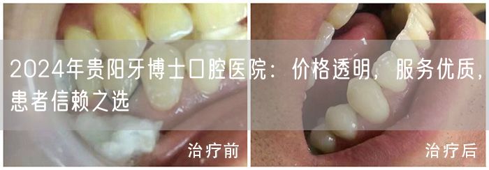 2024年贵阳牙博士口腔医院：价格透明，服务优质，患者信赖之选