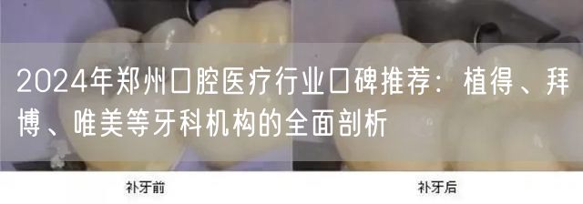 2024年郑州口腔医疗行业口碑推荐：植得、拜博、唯美等牙科机构的全面剖析