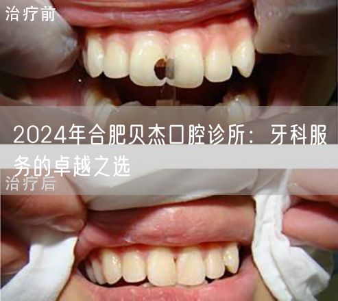 2024年合肥贝杰口腔诊所：牙科服务的卓越之选