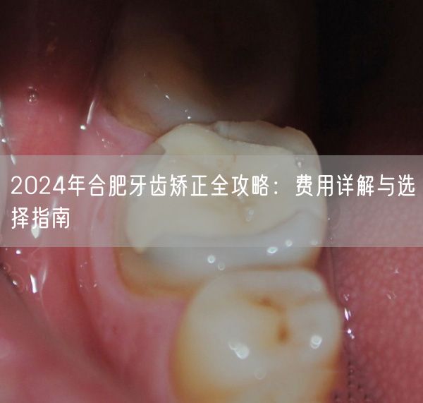 2024年合肥牙齿矫正全攻略：费用详解与选择指南