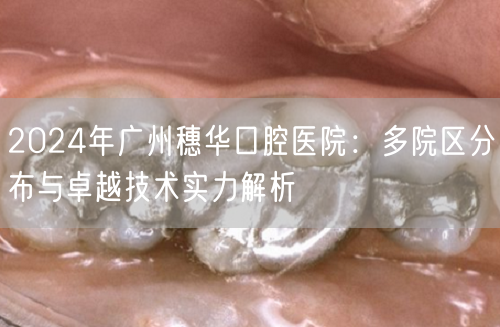 2024年广州穗华口腔医院：多院区分布与卓越技术实力解析