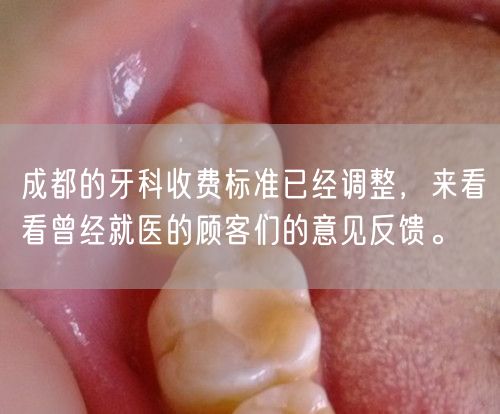 成都的牙科收费标准已经调整，来看看曾经就医的顾客们的意见反馈。