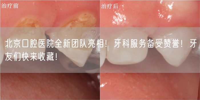 北京口腔医院全新团队亮相！牙科服务备受赞誉！牙友们快来收藏！
